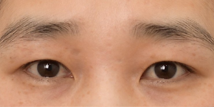 매몰 - Before